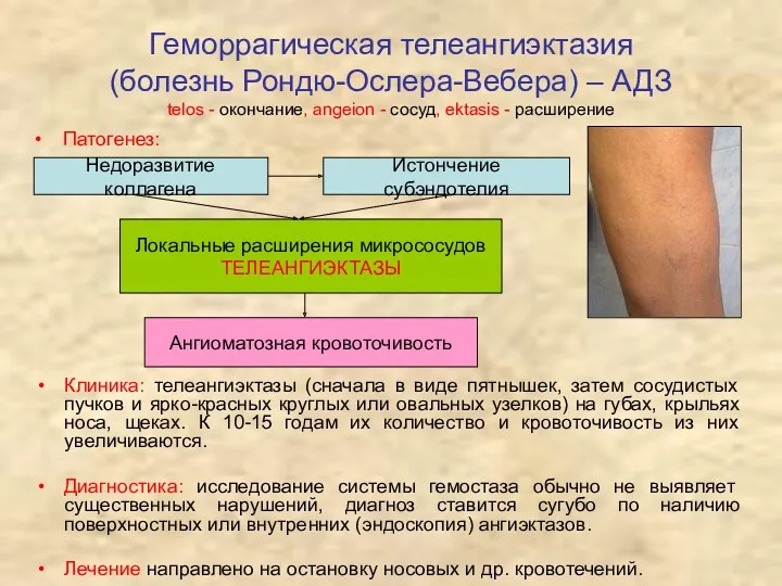 Геморрагическая телеангиэктазия (болезнь Рондю-Ослера-Вебера) – АДЗ telos - окончание, angeion