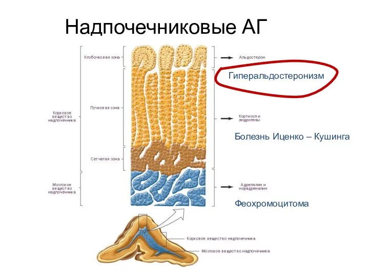 Надпочечниковые АГ Гиперальдостеронизм Болезнь Иценко – Кушинга Феохромоцитома
