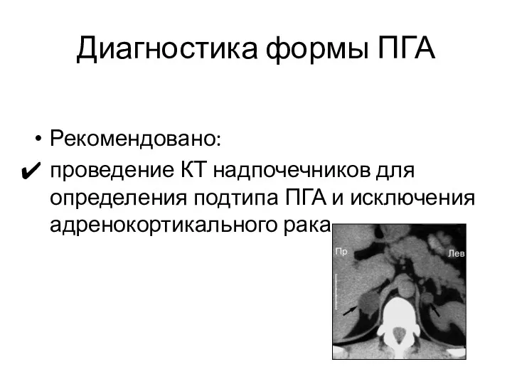 Диагностика формы ПГА Рекомендовано: проведение КТ надпочечников для определения подтипа ПГА и исключения адренокортикального рака