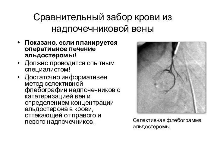 Сравнительный забор крови из надпочечниковой вены Показано, если планируется оперативное