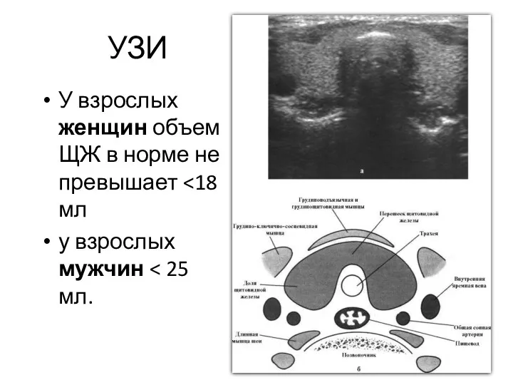 УЗИ У взрослых женщин объем ЩЖ в норме не превышает у взрослых мужчин