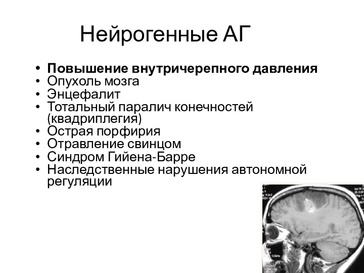 Нейрогенные АГ Повышение внутричерепного давления Опухоль мозга Энцефалит Тотальный паралич