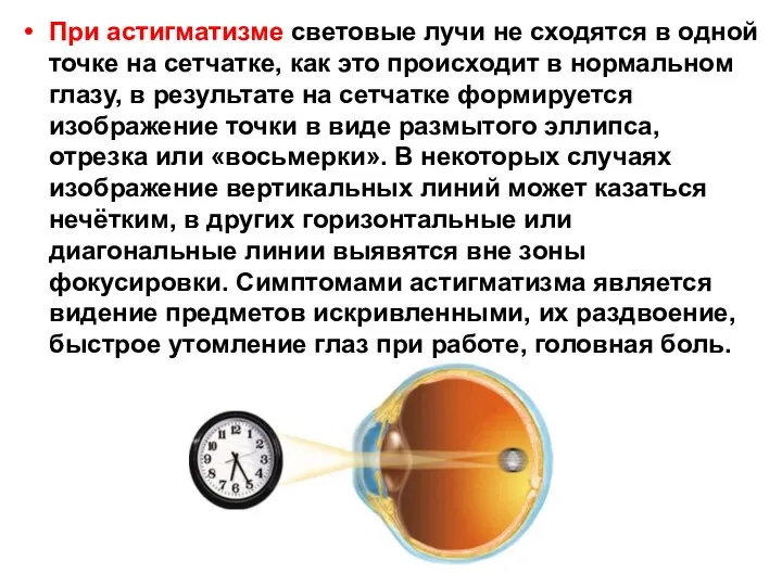 При астигматизме световые лучи не сходятся в одной точке на