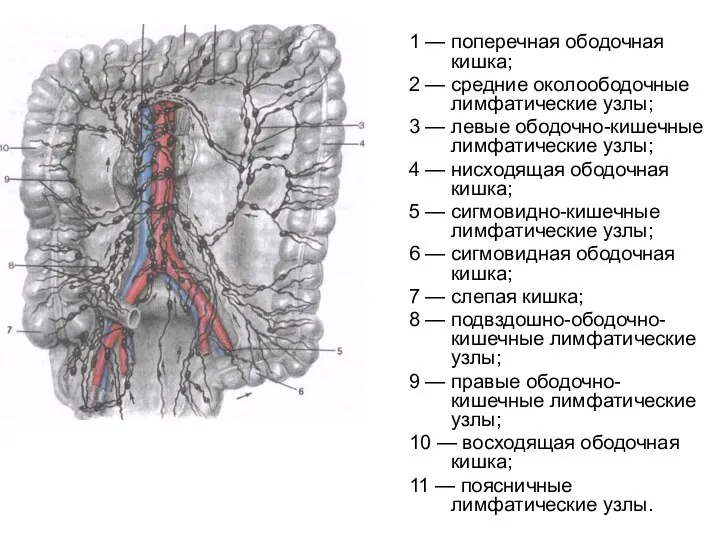 1 — поперечная ободочная кишка; 2 — средние околоободочные лимфатические узлы; 3 —