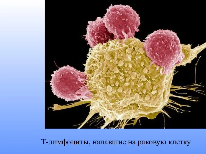 Т-лимфоциты, напавшие на раковую клетку