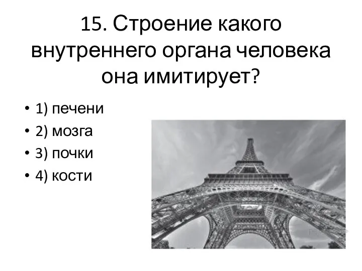 15. Строение какого внутреннего органа человека она имитирует? 1) печени 2) мозга 3) почки 4) кости