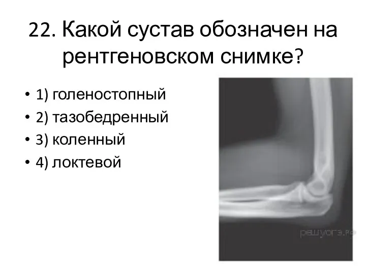 22. Какой сустав обозначен на рентгеновском снимке? 1) голеностопный 2) тазобедренный 3) коленный 4) локтевой