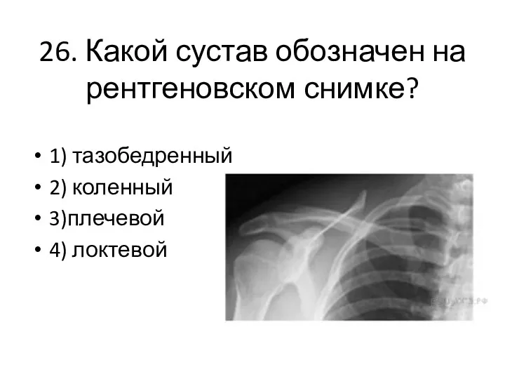 26. Какой сустав обозначен на рентгеновском снимке? 1) тазобедренный 2) коленный 3)плечевой 4) локтевой