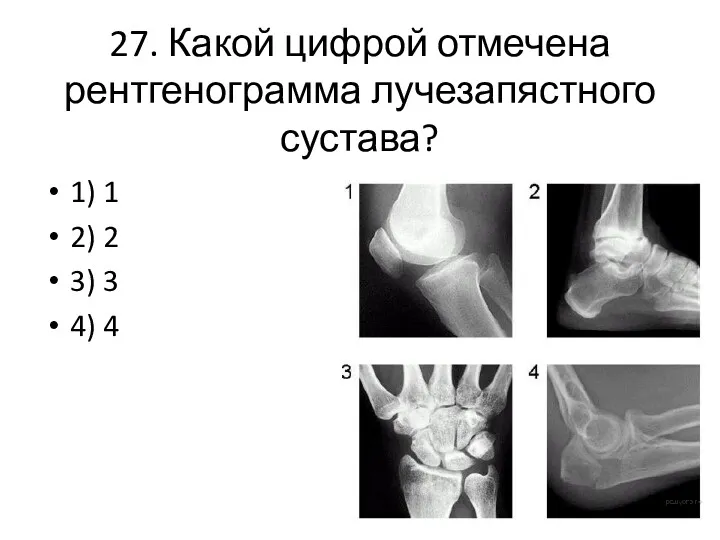 27. Какой цифрой отмечена рентгенограмма лучезапястного сустава? 1) 1 2) 2 3) 3 4) 4