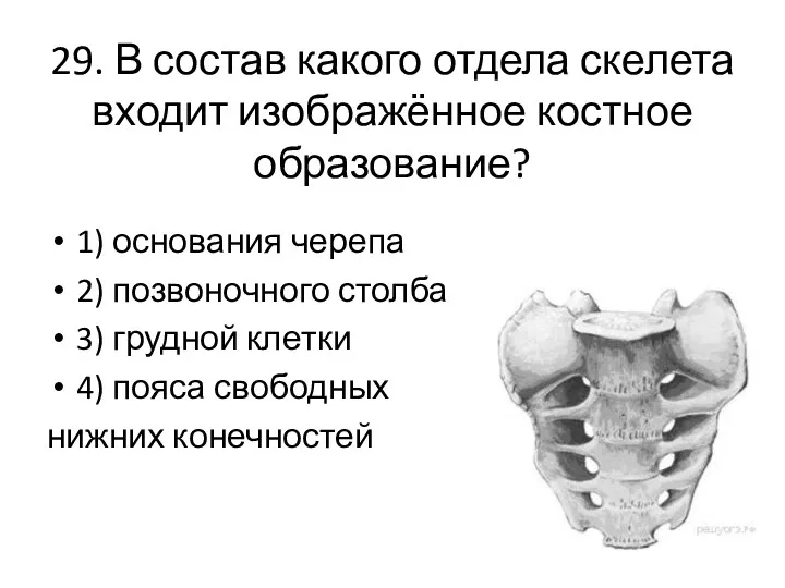 29. В состав какого отдела скелета входит изображённое костное образование?