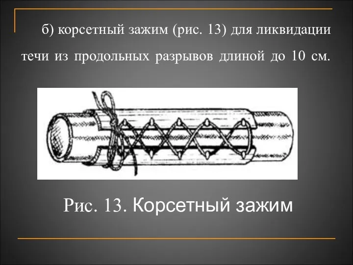 б) корсетный зажим (рис. 13) для ликвидации течи из продольных