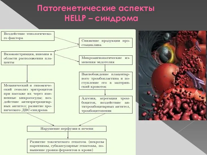 Патогенетические аспекты НЕLLP – cиндрома