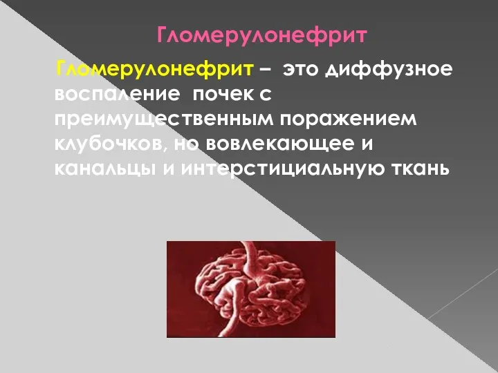 Гломерулонефрит Гломерулонефрит – это диффузное воспаление почек с преимущественным поражением клубочков, но вовлекающее