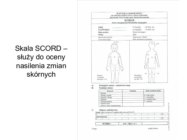 Skala SCORD – służy do oceny nasilenia zmian skórnych