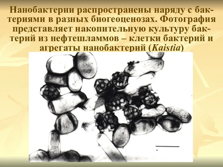 Нанобактерии распространены наряду с бак-териями в разных биогеоценозах. Фотография представляет