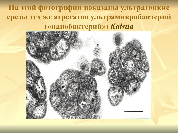 На этой фотографии показаны ультратонкие срезы тех же агрегатов ультрамикробактерий («нанобактерий») Kaistia