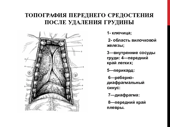 ТОПОГРАФИЯ ПЕРЕДНЕГО СРЕДОСТЕНИЯ ПОСЛЕ УДАЛЕНИЯ ГРУДИНЫ 1- ключица; 2- область