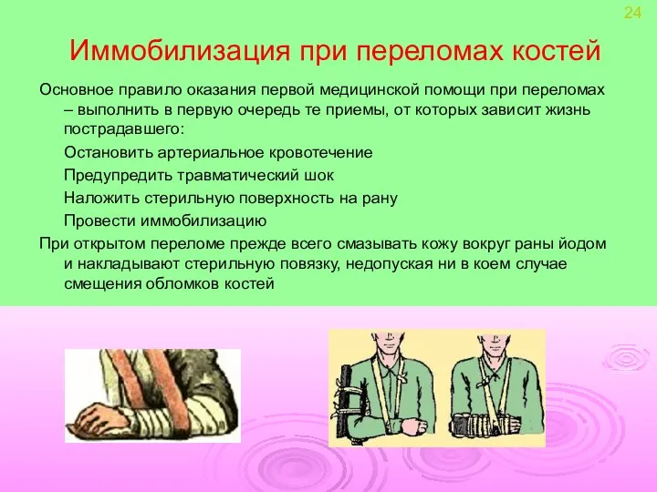 Иммобилизация при переломах костей Основное правило оказания первой медицинской помощи