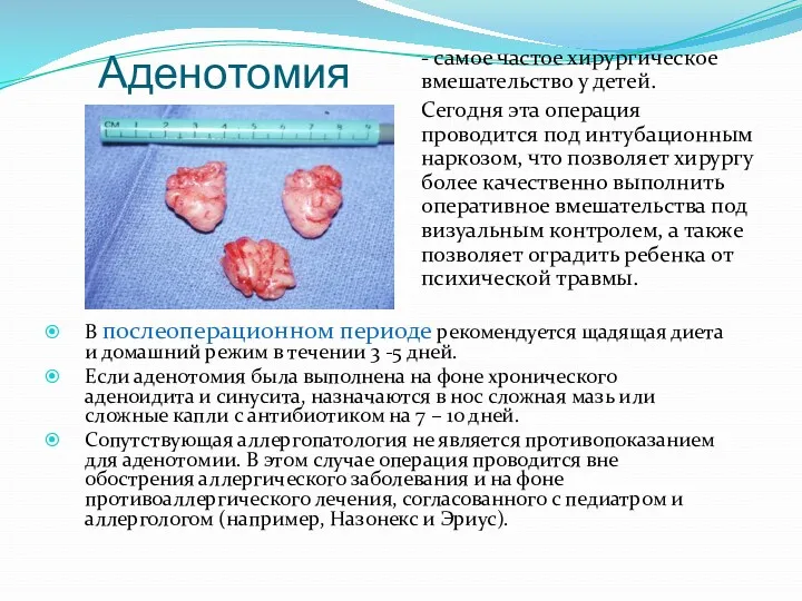 Аденотомия - самое частое хирургическое вмешательство у детей. Сегодня эта