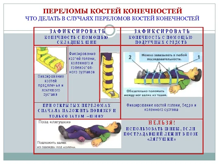 ПЕРЕЛОМЫ КОСТЕЙ КОНЕЧНОСТЕЙ ЧТО ДЕЛАТЬ В СЛУЧАЯХ ПЕРЕЛОМОВ КОСТЕЙ КОНЕЧНОСТЕЙ