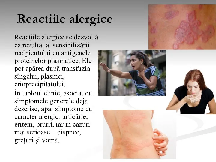 Reactiile alergice Reacţiile alergice se dezvoltă ca rezultat al sensibilizării recipientului cu antigenele