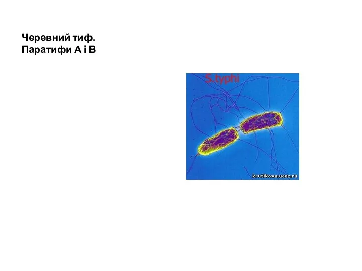 Черевний тиф.Паратифи А і В