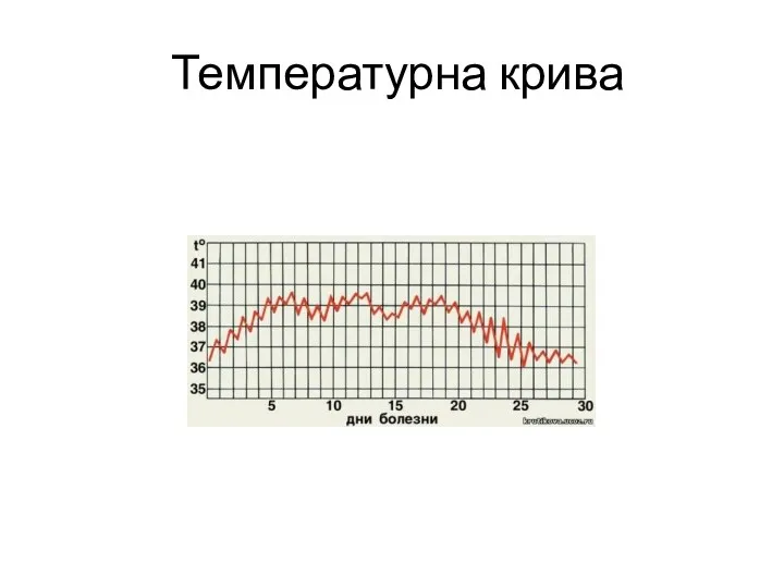 Температурна крива