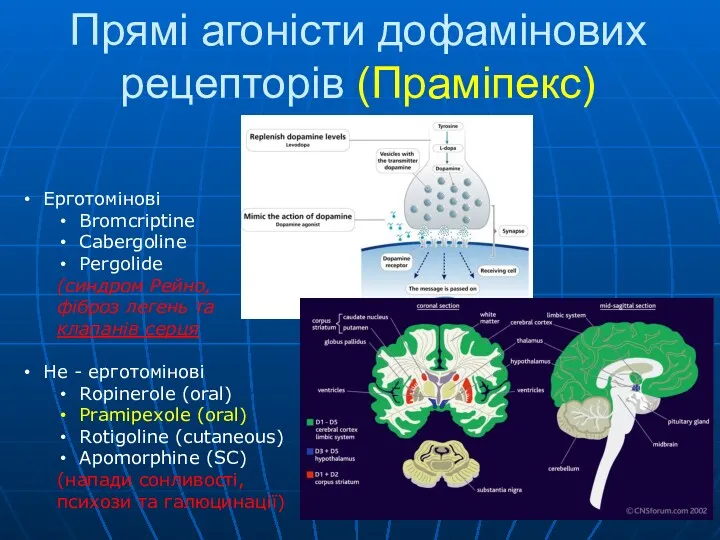 Прямі агоністи дофамінових рецепторів (Праміпекс) Ерготомінові Bromcriptine Cabergoline Pergolide (синдром