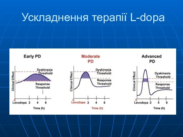 Ускладнення терапії L-dopa