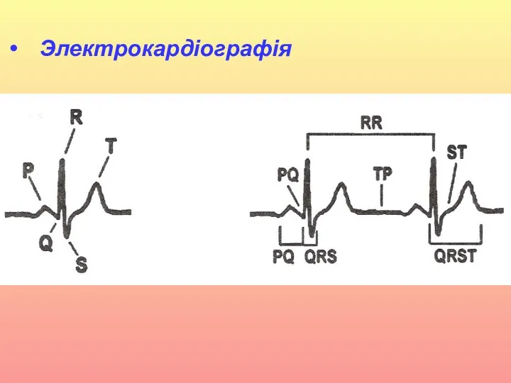 Электрокардіографія