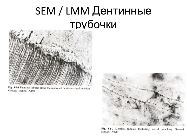 SEM / LMM Дентинные трубочки