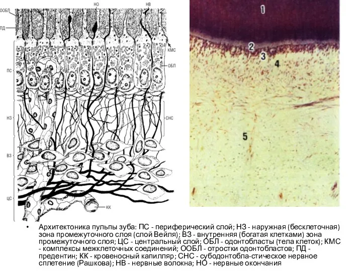 Архитектоника пульпы зуба: ПС - периферический слой; НЗ - наружная