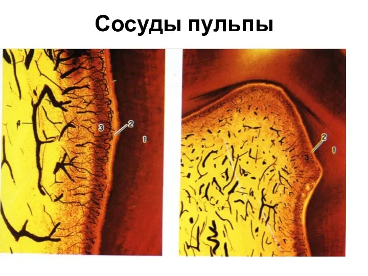 Сосуды пульпы