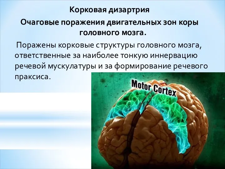 Корковая дизартрия Очаговые поражения двигательных зон коры головного мозга. Поражены