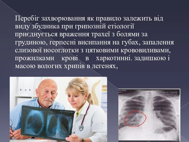 Перебіг захворювання як правило залежить від виду збудника при грипозній