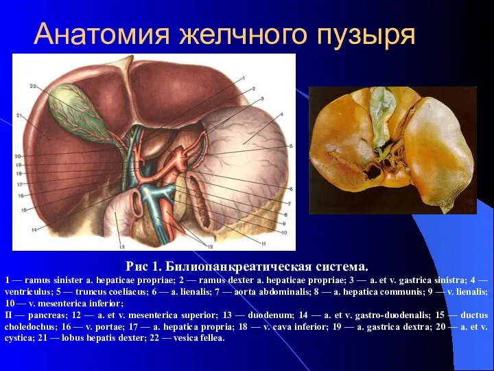 Анатомия желчного пузыря Рис 1. Билиопанкреатическая система. 1 — ramus sinister a. hepaticae