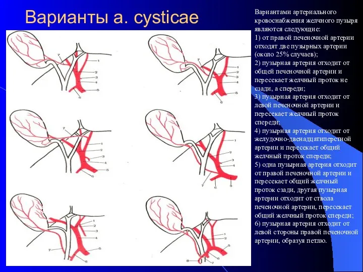 Варианты a. cysticae Вариантами артериального кровоснабжения желчного пузыря являются следующие: 1) от правой
