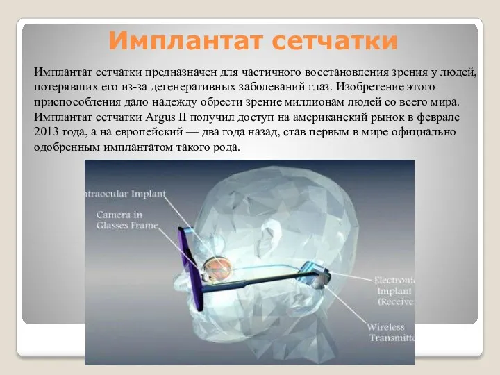 Имплантат сетчатки Имплантат сетчатки предназначен для частичного восстановления зрения у