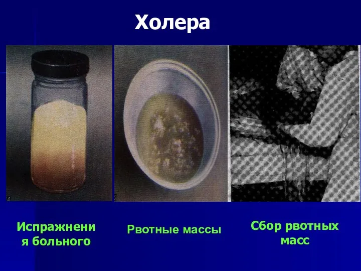 Испражнения больного Рвотные массы Сбор рвотных масс Холера