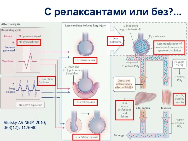 С релаксантами или без?... Slutsky AS NEJM 2010; 363(12): 1176-80