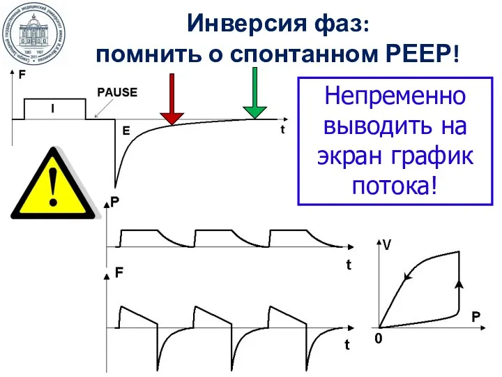 Инверсия фаз: помнить о спонтанном РЕЕР! Непременно выводить на экран график потока!