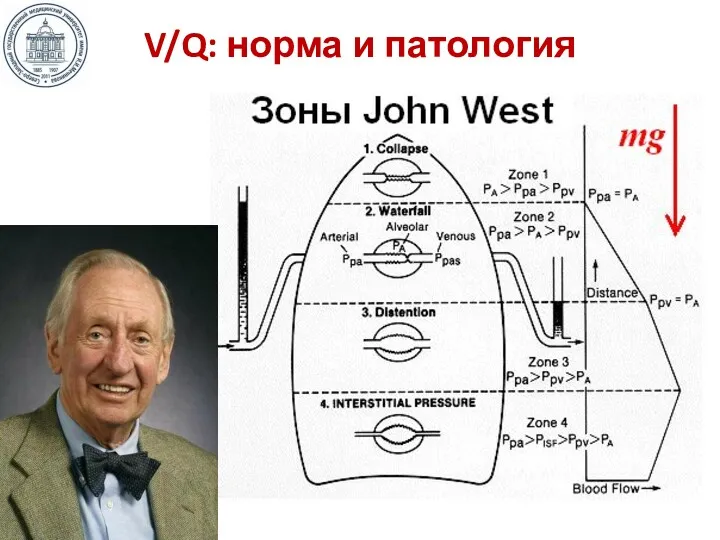 V/Q: норма и патология