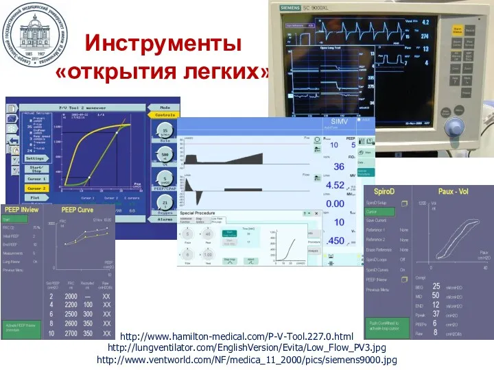 http://www.hamilton-medical.com/P-V-Tool.227.0.html Инструменты «открытия легких» http://www.ventworld.com/NF/medica_11_2000/pics/siemens9000.jpg http://lungventilator.com/EnglishVersion/Evita/Low_Flow_PV3.jpg