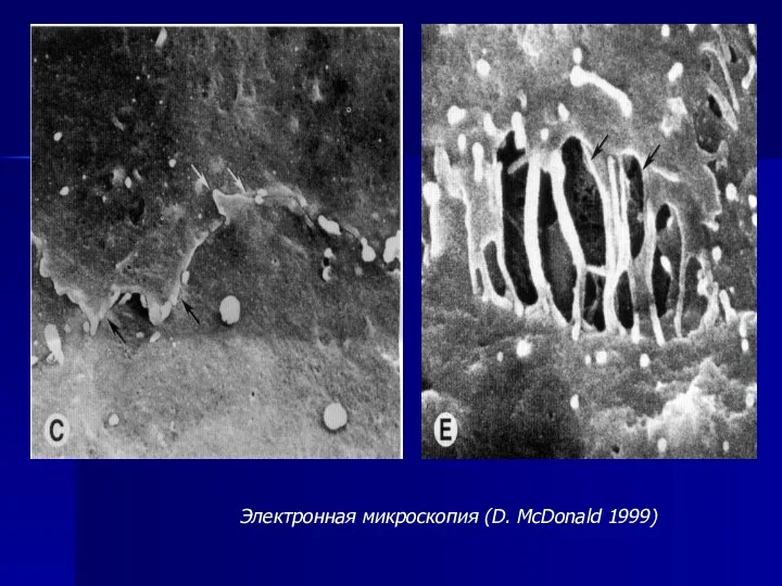 Электронная микроскопия (D. McDonald 1999)