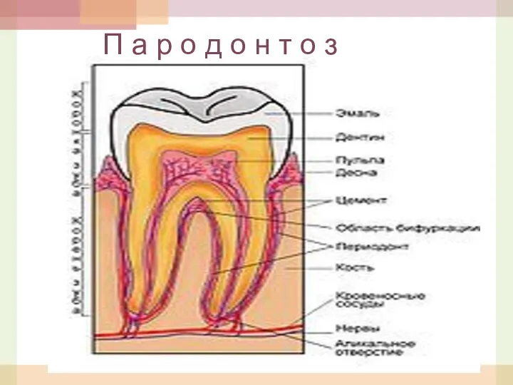 П а р о д о н т о з