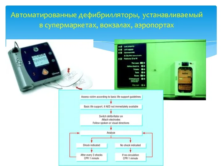 Автоматированные дефибрилляторы, устанавливаемый в супермаркетах, вокзалах, аэропортах