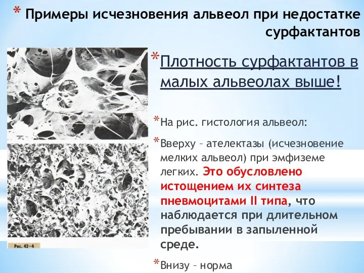 Примеры исчезновения альвеол при недостатке сурфактантов Плотность сурфактантов в малых