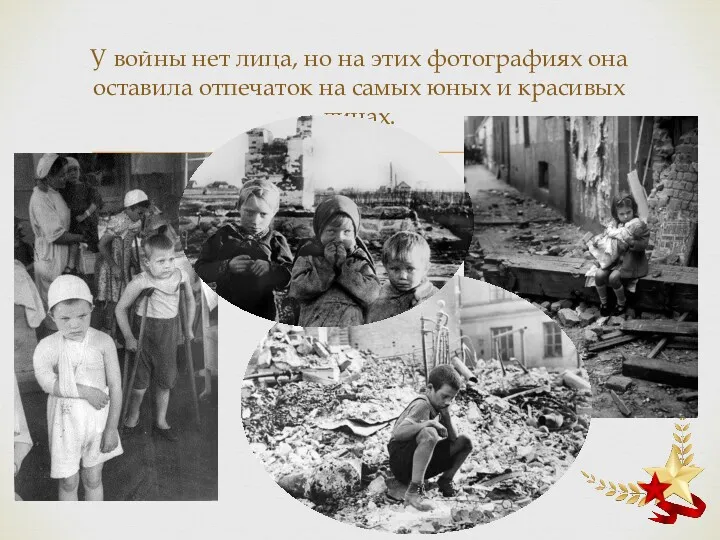 У войны нет лица, но на этих фотографиях она оставила