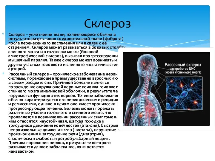 Склероз – уплотнение ткани, появляющееся обычно в результате разрастания соединительной