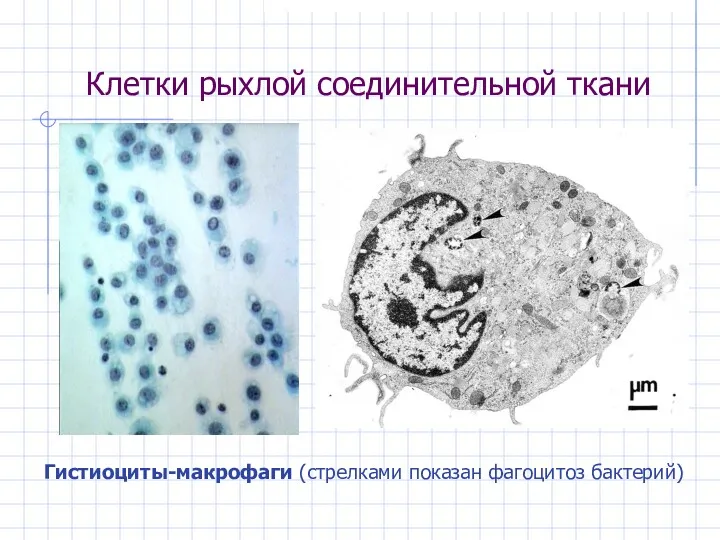 Клетки рыхлой соединительной ткани Гистиоциты-макрофаги (стрелками показан фагоцитоз бактерий)